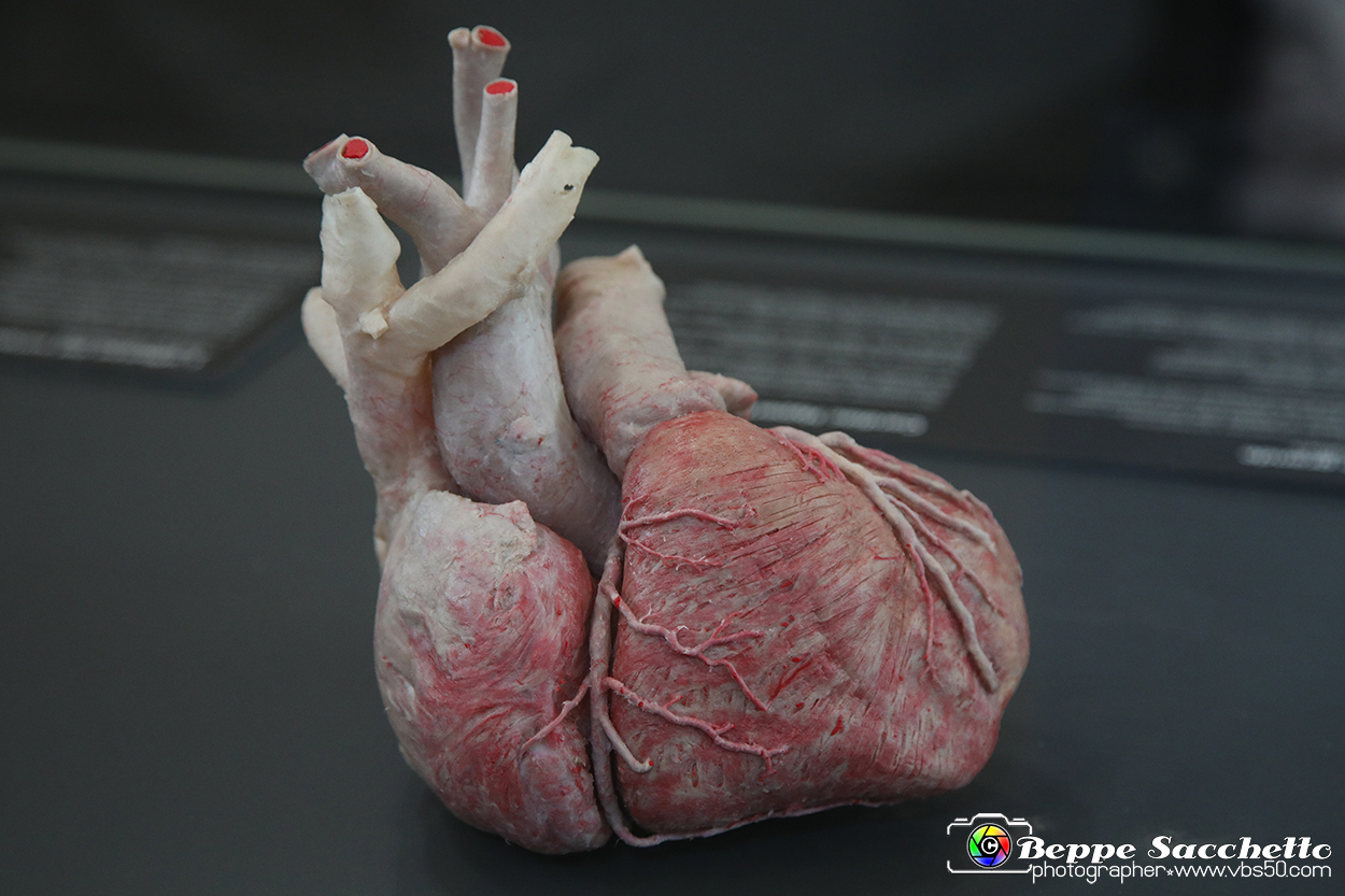 VBS_2857 - Cuore. Ipertrofia cardiaca - Mostra Body Worlds.jpg